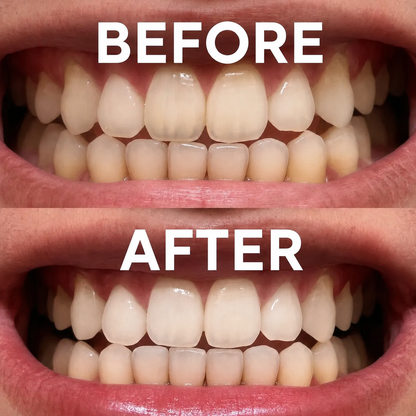 WhiteMe - V34 (whitening serum)